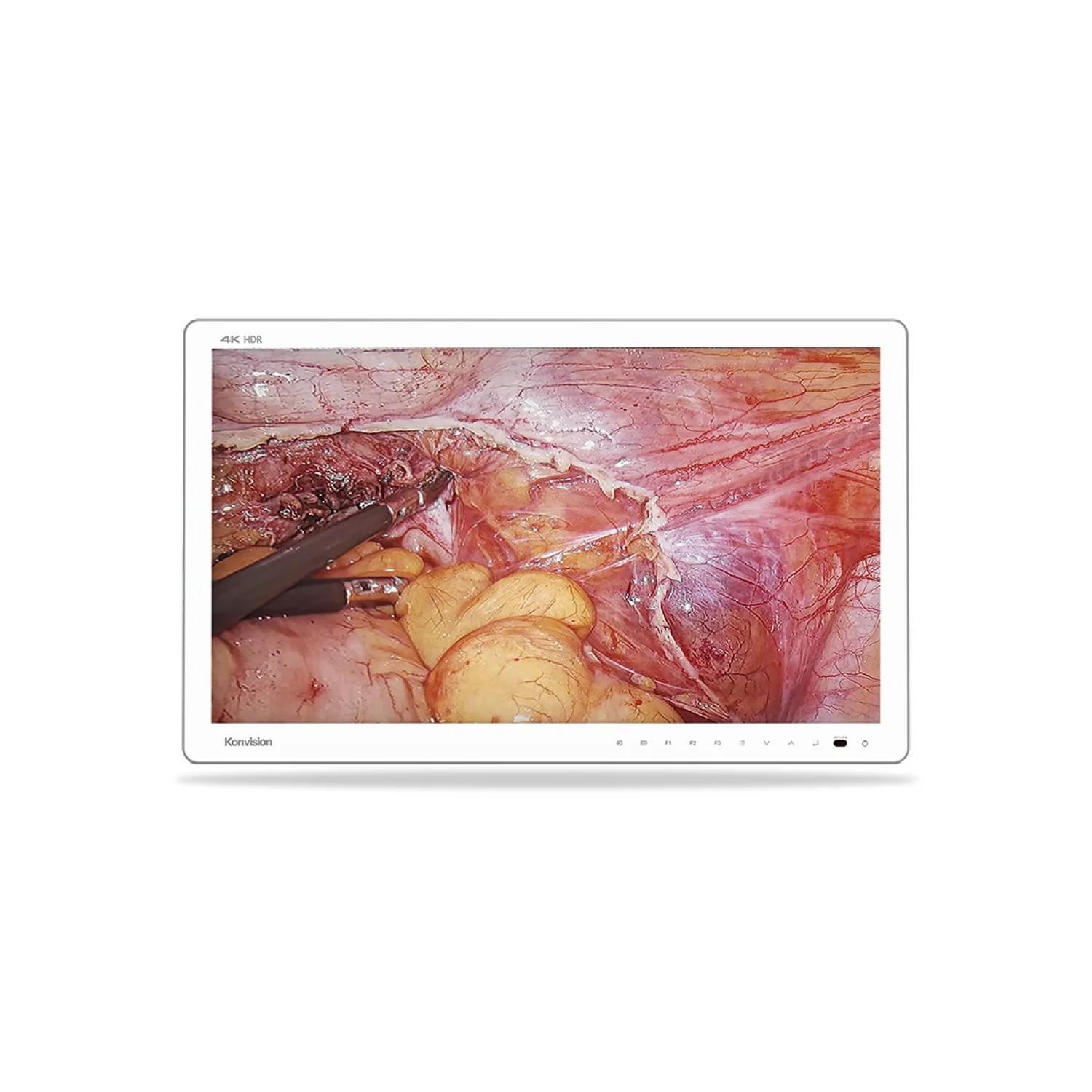 Konvision MS-E2710H 27" 4K HDR Surgical Monitor